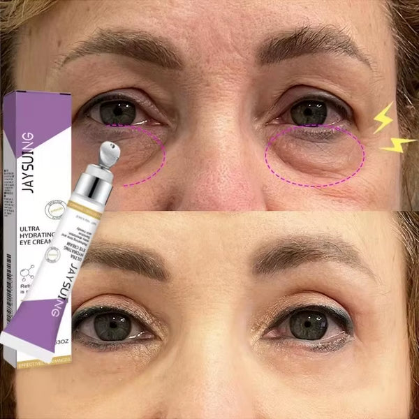 Instant Eye Bag Removal Cream Retinol Anti-Wrinkle Firming Skin Fade Fine Lines anti Dark Circle Puffiness Brighten Eye Care