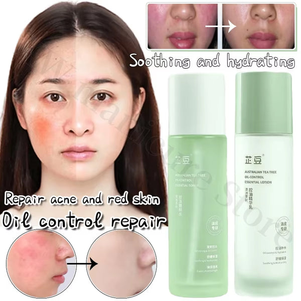 Tea Tree Essence Set Oil Control Acne Removal Skin Soothing Hydrating Oily Skin Care Unisex Water Lotion Two-Piece Set Skin Care