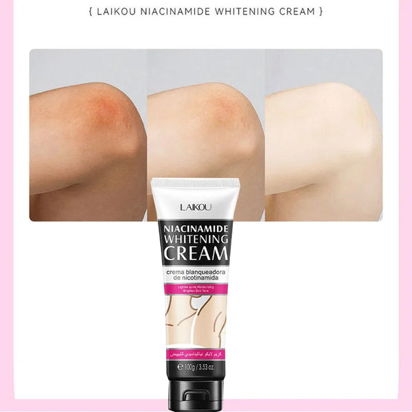 100G  Nicotinamide Body Cream Lighten Spots Moisturizing and Hydrating Brighten Skin Tone Skin Care