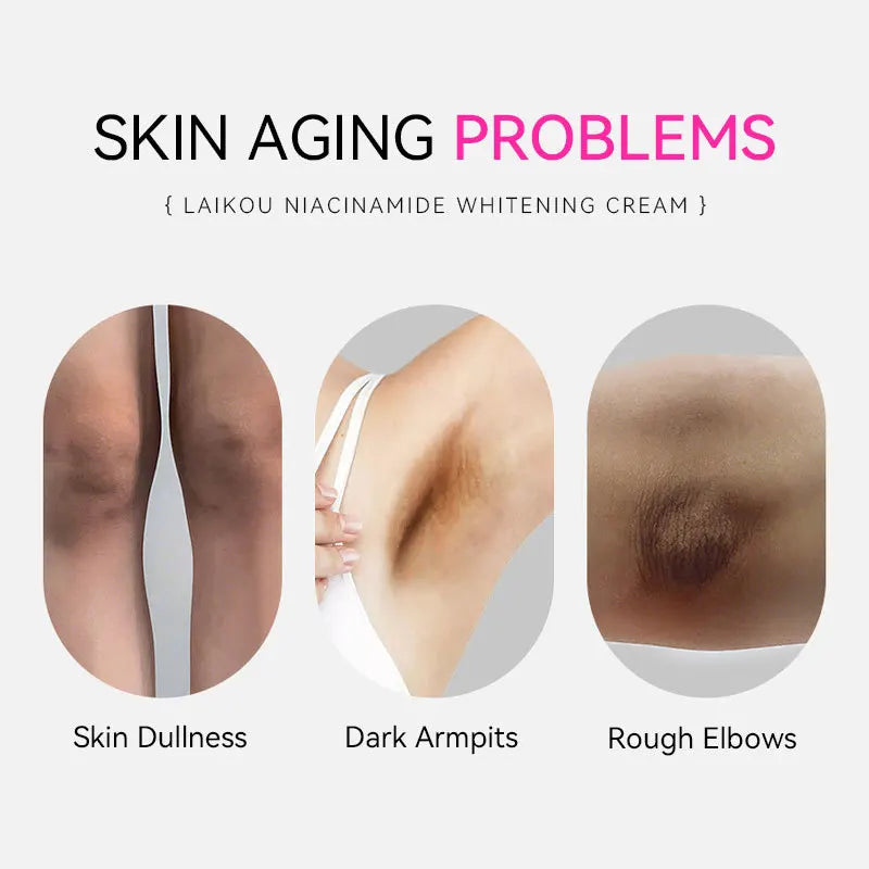 100G  Nicotinamide Body Cream Lighten Spots Moisturizing and Hydrating Brighten Skin Tone Skin Care